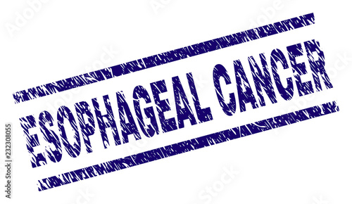 ESOPHAGEAL CANCER seal stamp with distress style. Blue vector rubber print of ESOPHAGEAL CANCER tag with scratched texture. Text tag is placed between parallel lines.