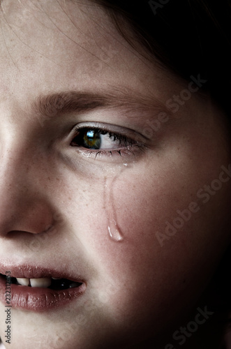 Obraz na plátne Girl Crying with Tears on Face Cheek Falling