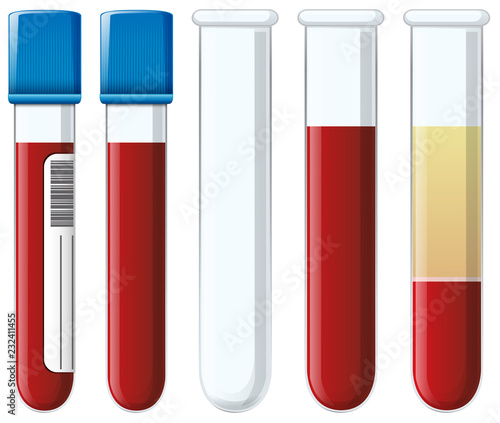 Set of blood collection tubes