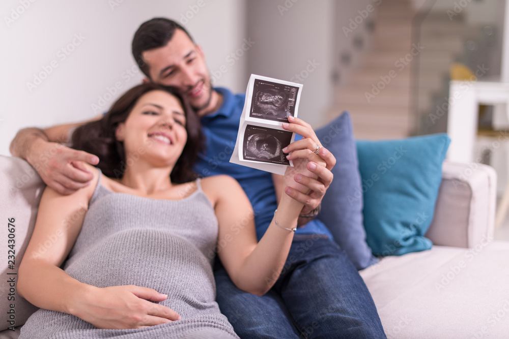 pregnant couple looking baby's ultrasound pregnant couple looking baby's ultrasound