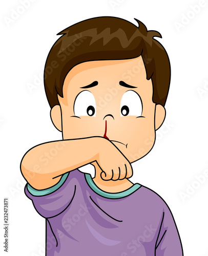 Kid Boy Nosebleed Illustration