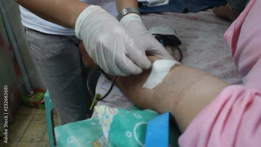 nurse removes the needle from the arm of a blood donor nurse removes the needle from the arm of a blood donor