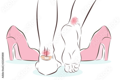 female feet in pain