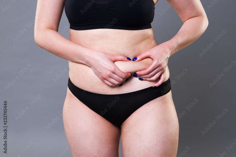 Woman holding fold of skin, cellulite on female body on gray background Woman holding fold of skin, cellulite on female body on gray background