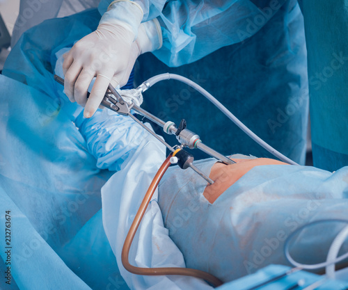 Process of gynecological surgery operation using laparoscopic equipment. Group of surgeons in operating room with surgery equipment