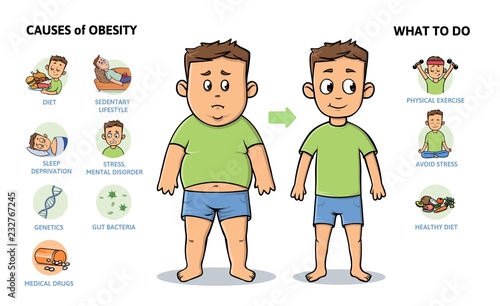 Obesity causes and prevention. Young guy before and after diet and fitness. Infographic poster with text and character. Flat vector illustration, horizontal. Isolated on white background.