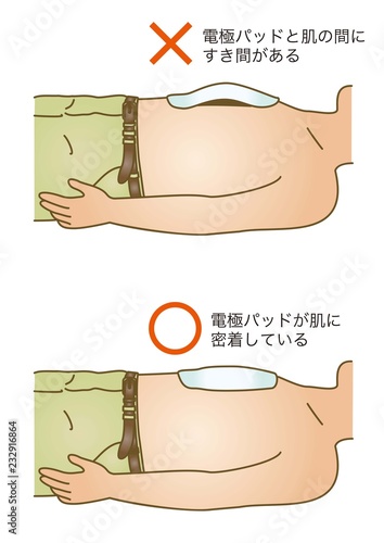 応急手当イラスト95：AED