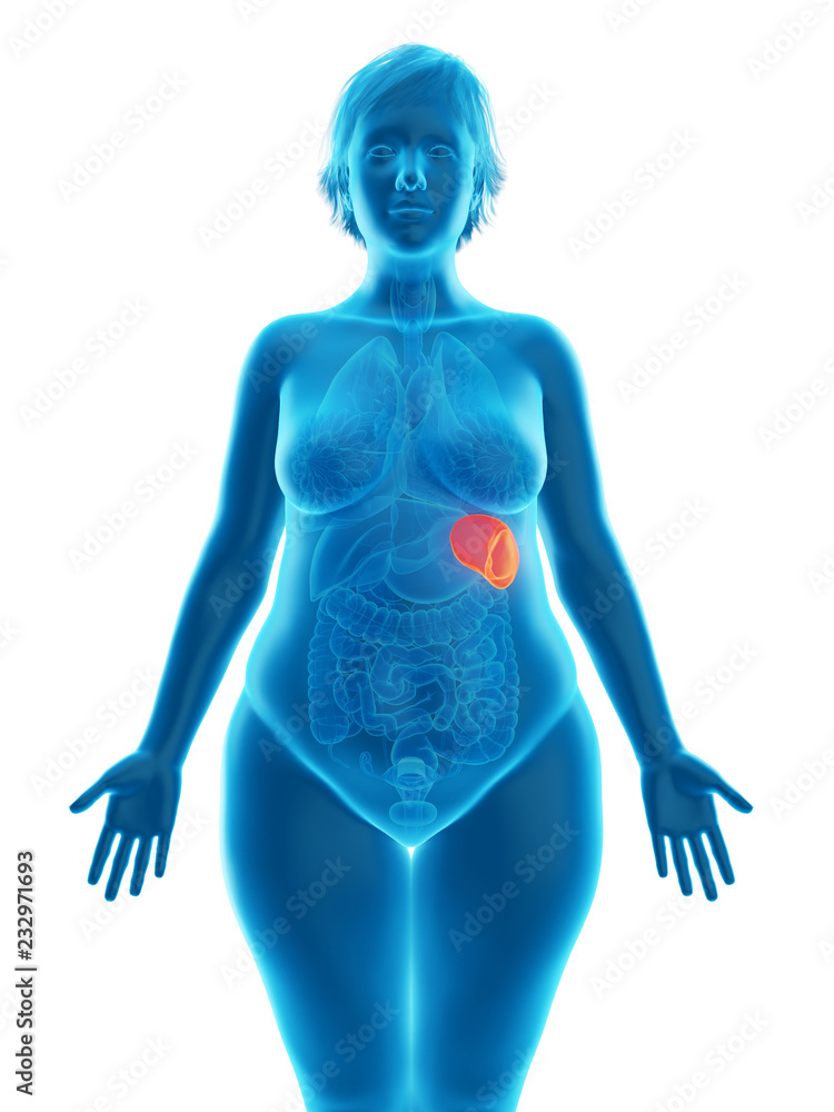 3d rendered medically accurate illustration of an obese womans spleen 3d rendered medically accurate illustration of an obese womans spleen