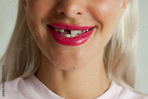 Fotografie, Obraz Toothless smile