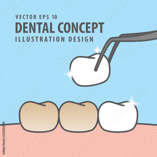 Square banner Putting new veneer on discolored tooth illustration vector on blue background. Dental concept.