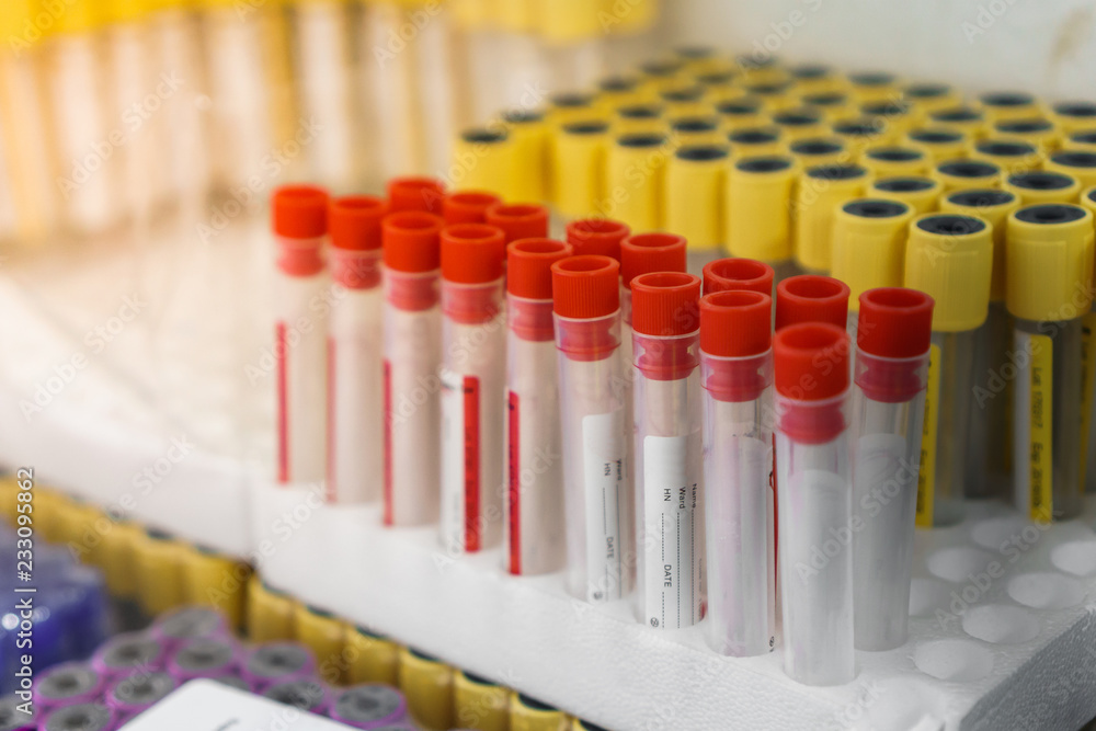 A lot of Blood sample tubes empty in laboratory test, Selective focus. A lot of Blood sample tubes empty in laboratory test, Selective focus.