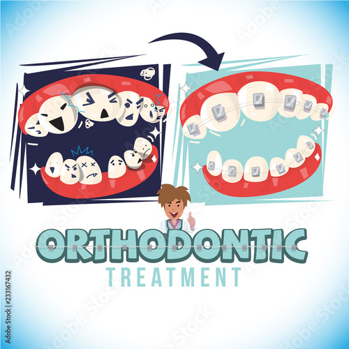 before and after of orthodontist treatment. come  with typographic design - vector
