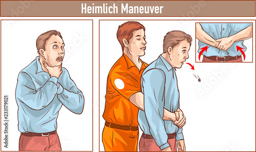 Clip Art of One man stands behind the conscious victim with his hands in the proper position on the victim's abdomen to perform the Heimlich maneuver photo