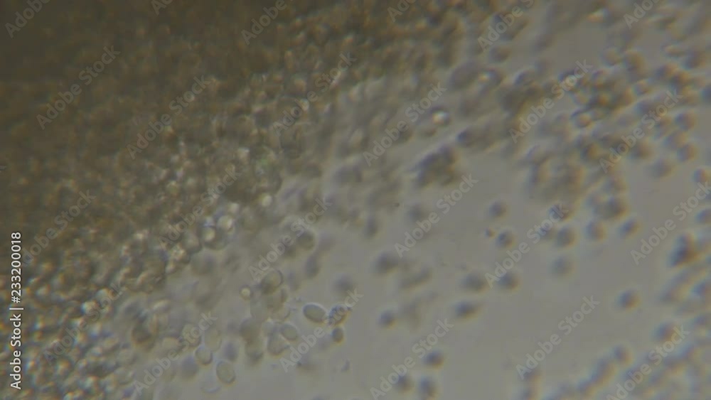 Budding yeast cell under the microscope. Budding yeast cell under the microscope.