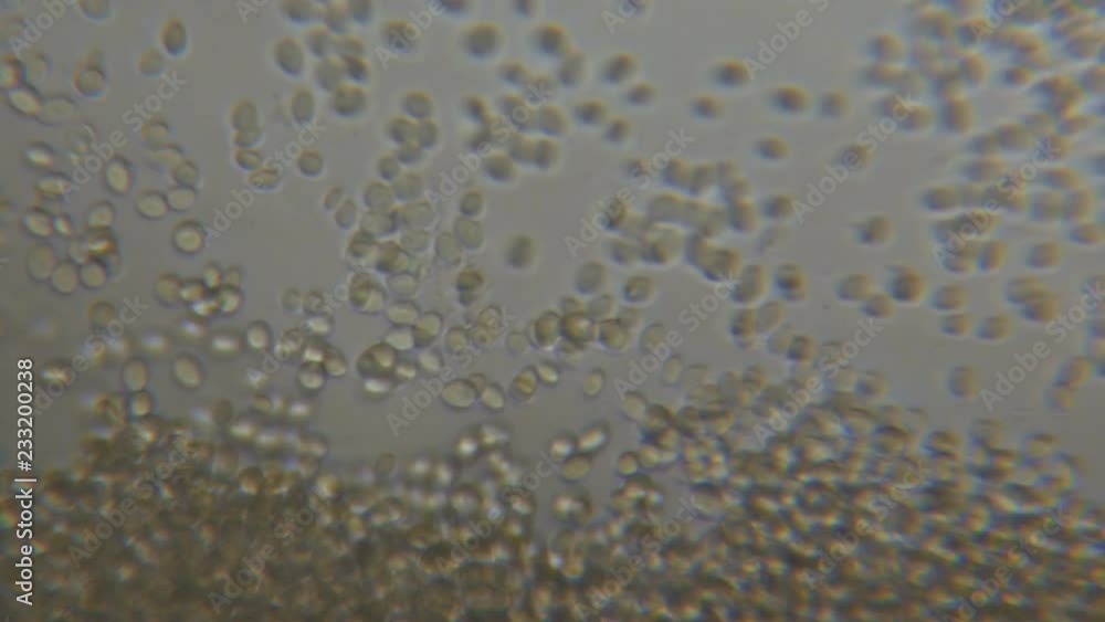 Budding yeast cell under the microscope. Budding yeast cell under the microscope.