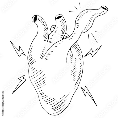 Heart Organ Attack Clogged Artery