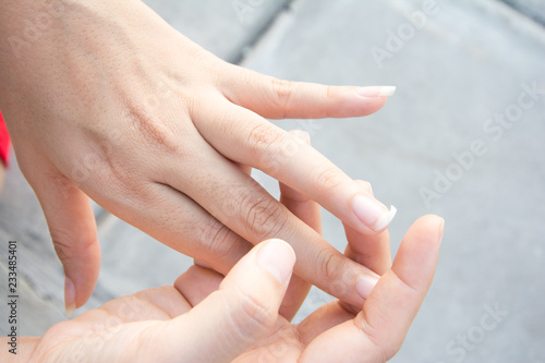 Image of a broken nail hand