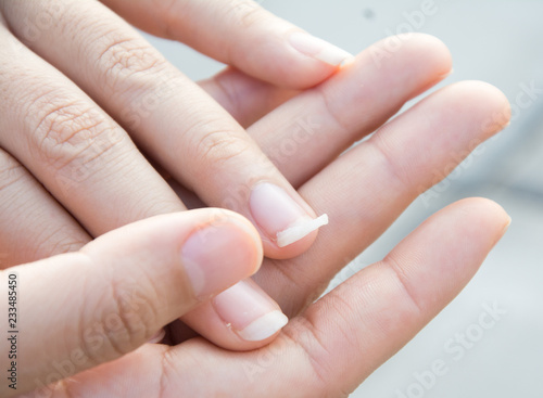 Image of a broken nail hand