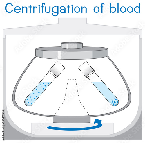 Centrifugation of blood machine