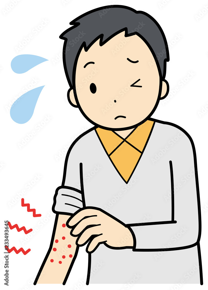 皮膚のかゆみ Stock イラスト Adobe Stock