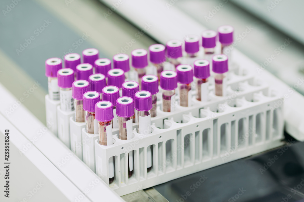 Complete blood count (CBC) test tubes in the rack for automation