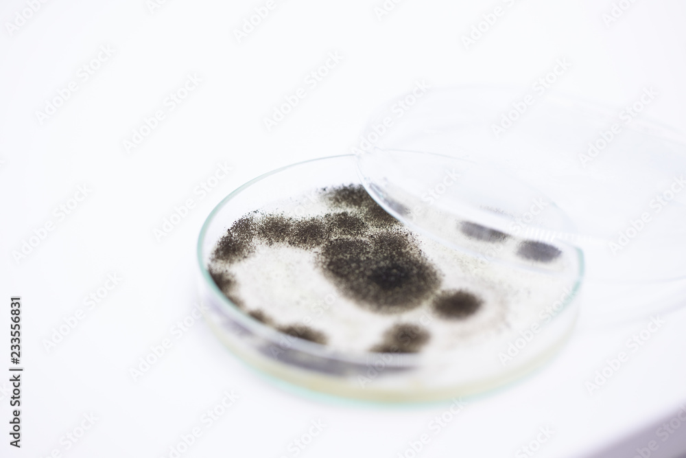 Aspergillus (mold) for Microbiology in Lab. Aspergillus (mold) for Microbiology in Lab.