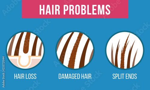Hair care. Common problems - split ends, damaged, hair loss Vector
