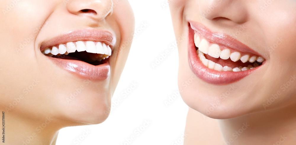 Obraz premium Piękny szeroki uśmiech młode świeże kobiety z wielkimi zdrowymi białymi zębami, odizolowywającymi nad białym tłem. Uśmiechnięte szczęśliwe kobiety. Śmiejąc się kobiece usta. Zęby zdrowia, wybielanie, protetyka i pielęgnacja