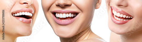 Beautiful wide smile of young fresh women with great healthy white teeth, isolated over white background. Smiling happy women. Laughing female mouth.Teeth health, whitening, prosthetics and care photo