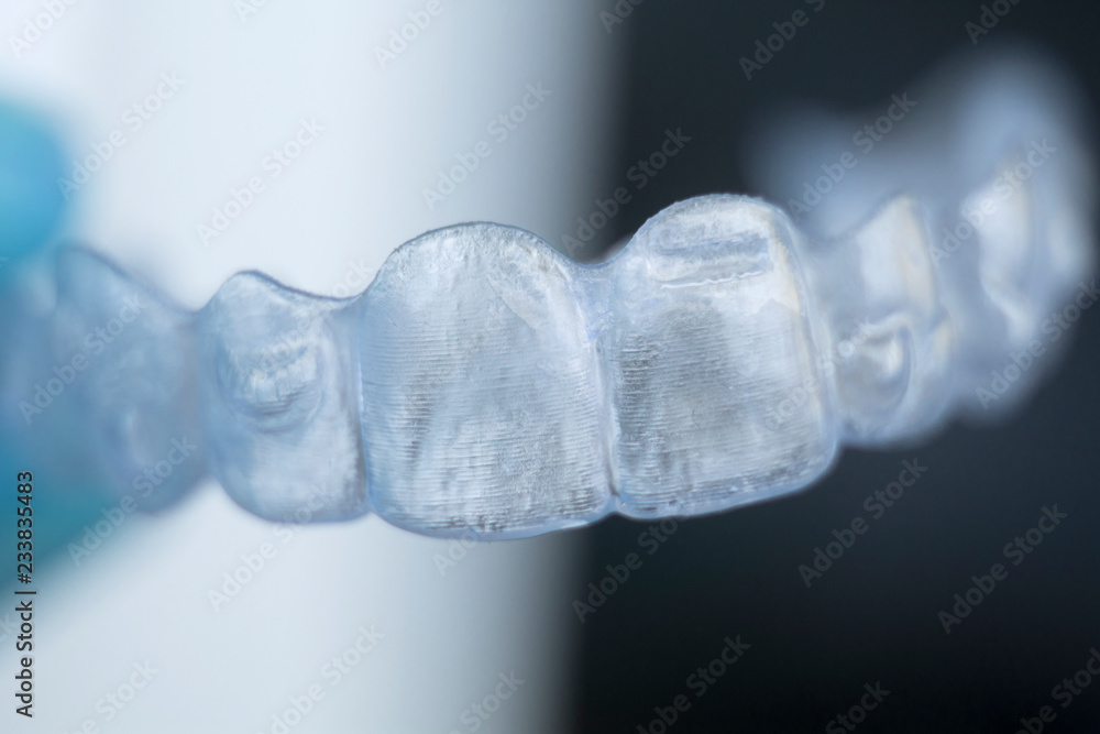 Invisible bracket teeth aligners Invisible bracket teeth aligners