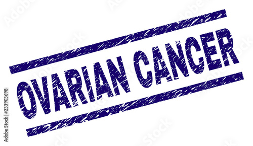 OVARIAN CANCER seal print with grunge style. Blue vector rubber print of OVARIAN CANCER caption with dirty texture. Text caption is placed between parallel lines.