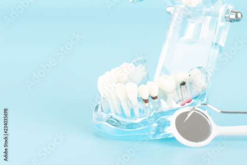 Dental check up with dental model in oral health care concept.