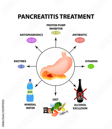 Pancreatitis treatment. The structure of the stomach and pancreas. Infographics. Vector illustration on isolated background.