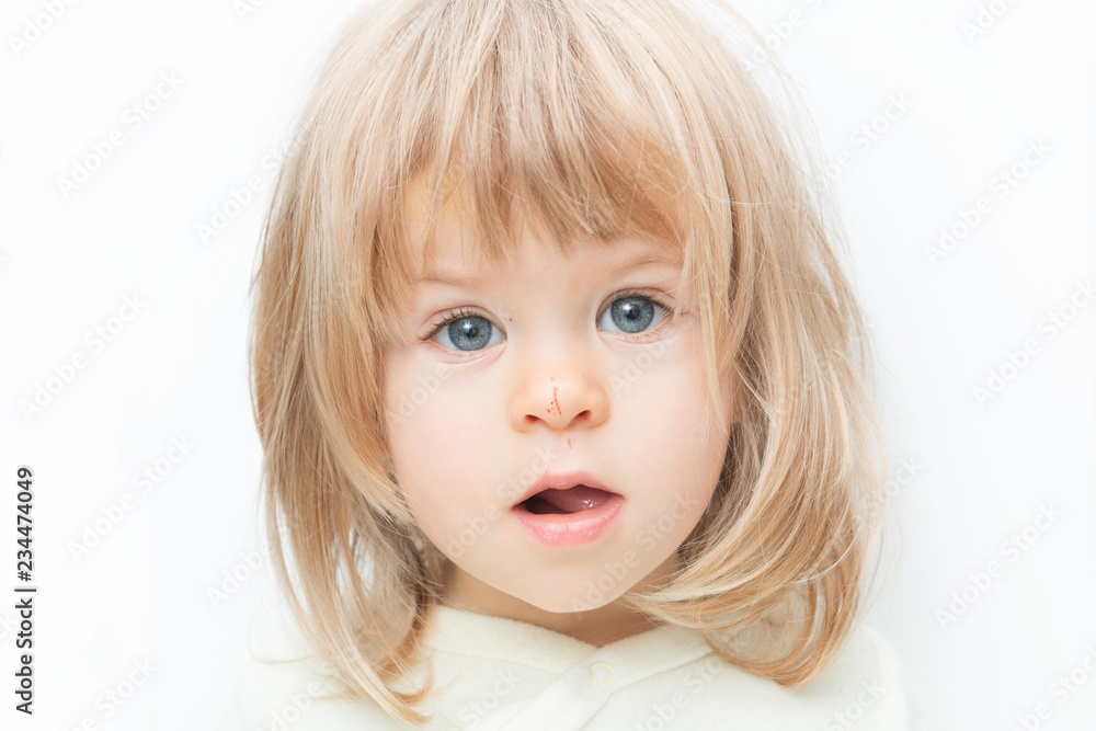 Close up portrait blond hair baby girl with a scratch on her nose isolated on the white background. Surprised female toddler, keeps mouth opened. Child safety concept, injuries from falling down. Close up portrait blond hair baby girl with a scratch on her nose isolated on the white background. Surprised female toddler, keeps mouth opened. Child safety concept, injuries from falling down.