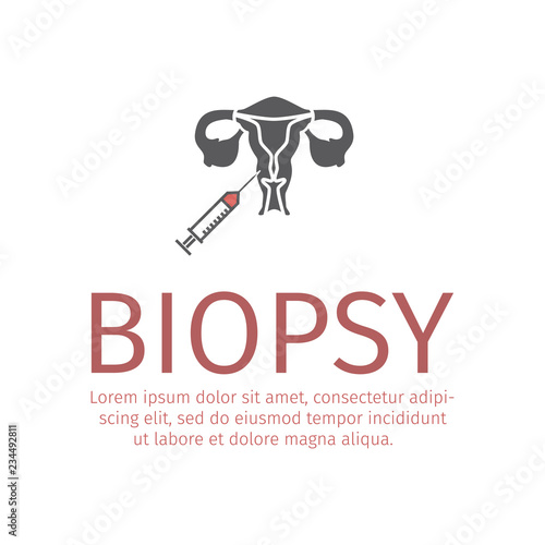Uterus Biopsy flat icon. Vector sign for web graphic.