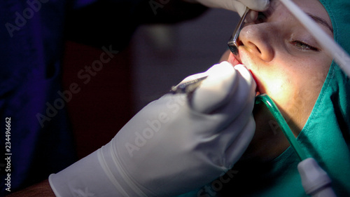 Oral surgery operation,cist apicoectomy, dark operation room