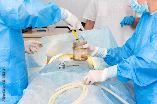 Surgical team performing cosmetic surgery in hospital operating room. Surgeon working on a patient. Breast augmentation, enlargement, enhancement at medical clinic. Mammaplasty.