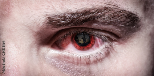 Red eye of exhausted soldier with soldiers reflecting in the iris