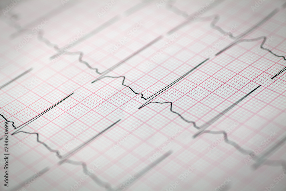 Close-up of an electrocardiogram, Medical and healthcare concept. Close-up of an electrocardiogram, Medical and healthcare concept.