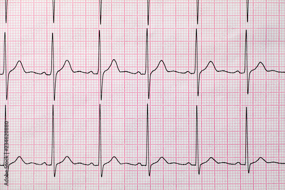 Background of electrocardiogram,  Medical and healthcare concept.