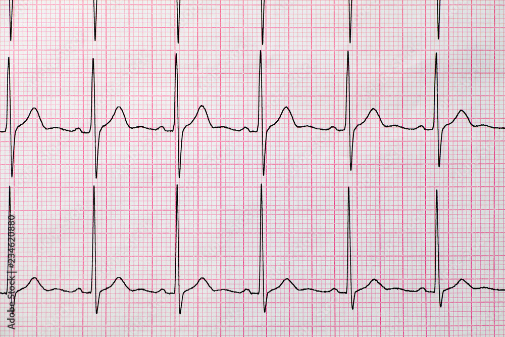 Background of electrocardiogram, Medical and healthcare concept. Background of electrocardiogram, Medical and healthcare concept.
