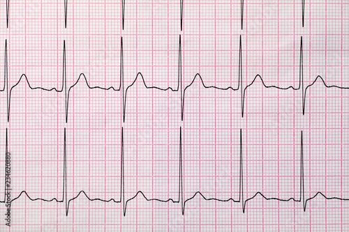 Background of electrocardiogram, Medical and healthcare concept.