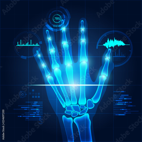 hand x-ray with technology theme, concept of healthcare technology