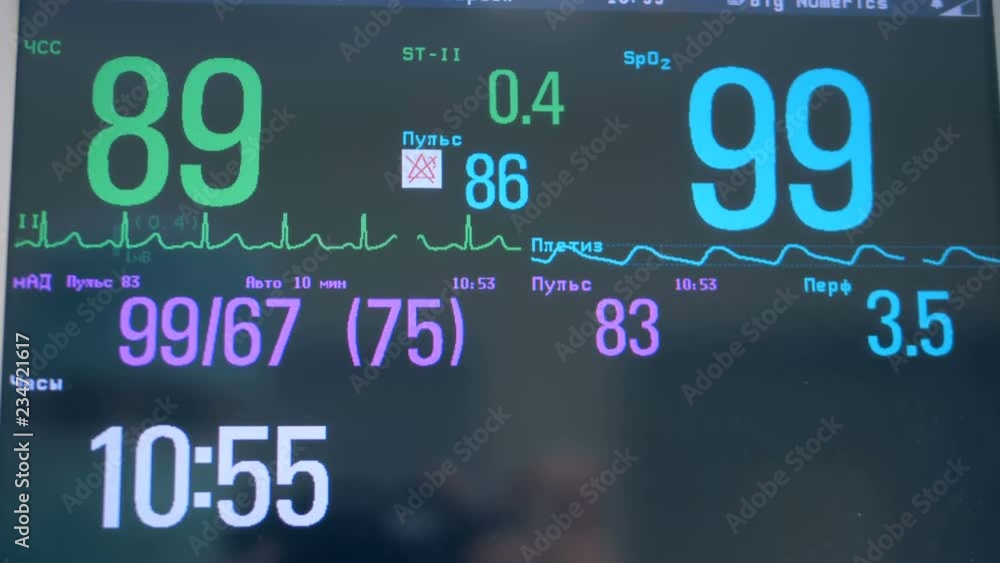 Close up of various figures and indexes on a medical screen. ECG monitor. Close up of various figures and indexes on a medical screen. ECG monitor.