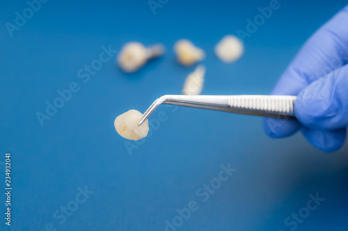 A dentist is holding tweezers for dental ceramic veneers and crowns. © Dmitry