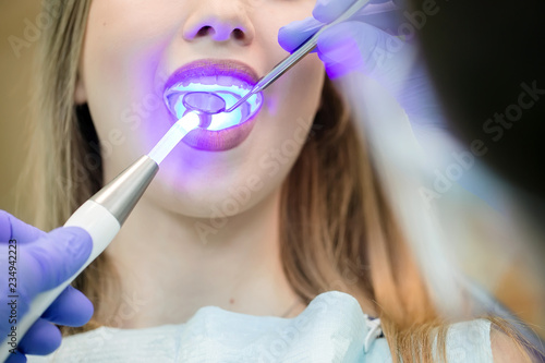 Dentist doing procedure with dental curing UV light in clinic