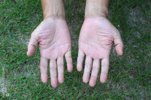 two bare hands with grass background