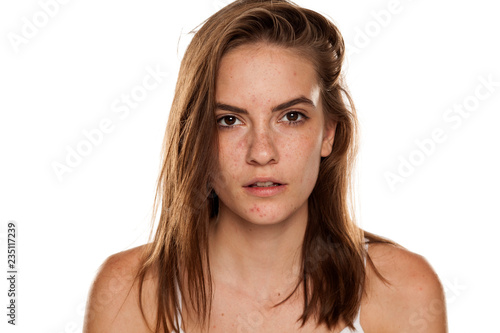 Portrait of young beautiful woman with frackles and problematic skin on white backgeound