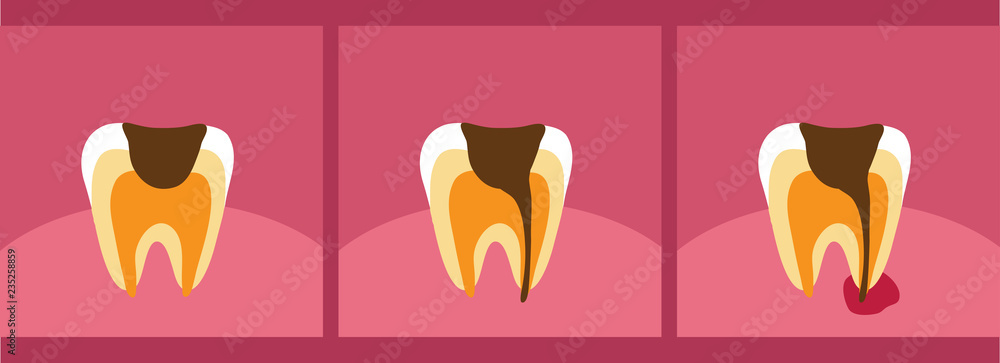 Проблемный зуб
