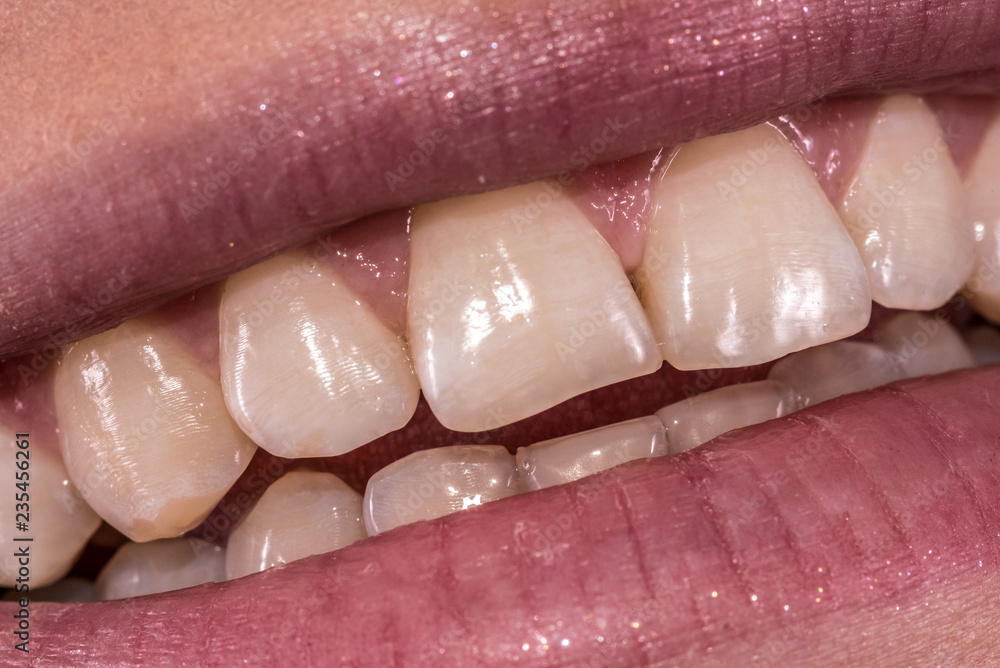 Obraz premium Woman smile with great natural teeth